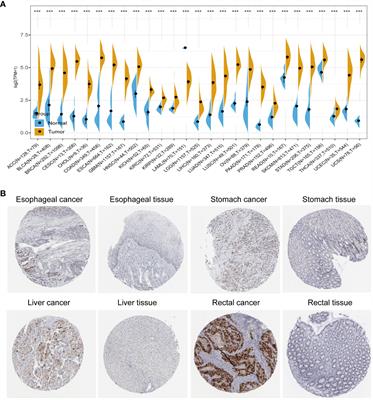 Frontiers Pan Cancer Analysis And In Vitro Validation Of The